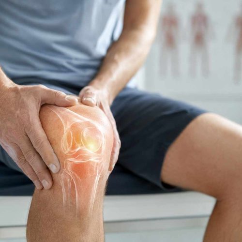 Knacken die Gelenke wirklich von Arthrose